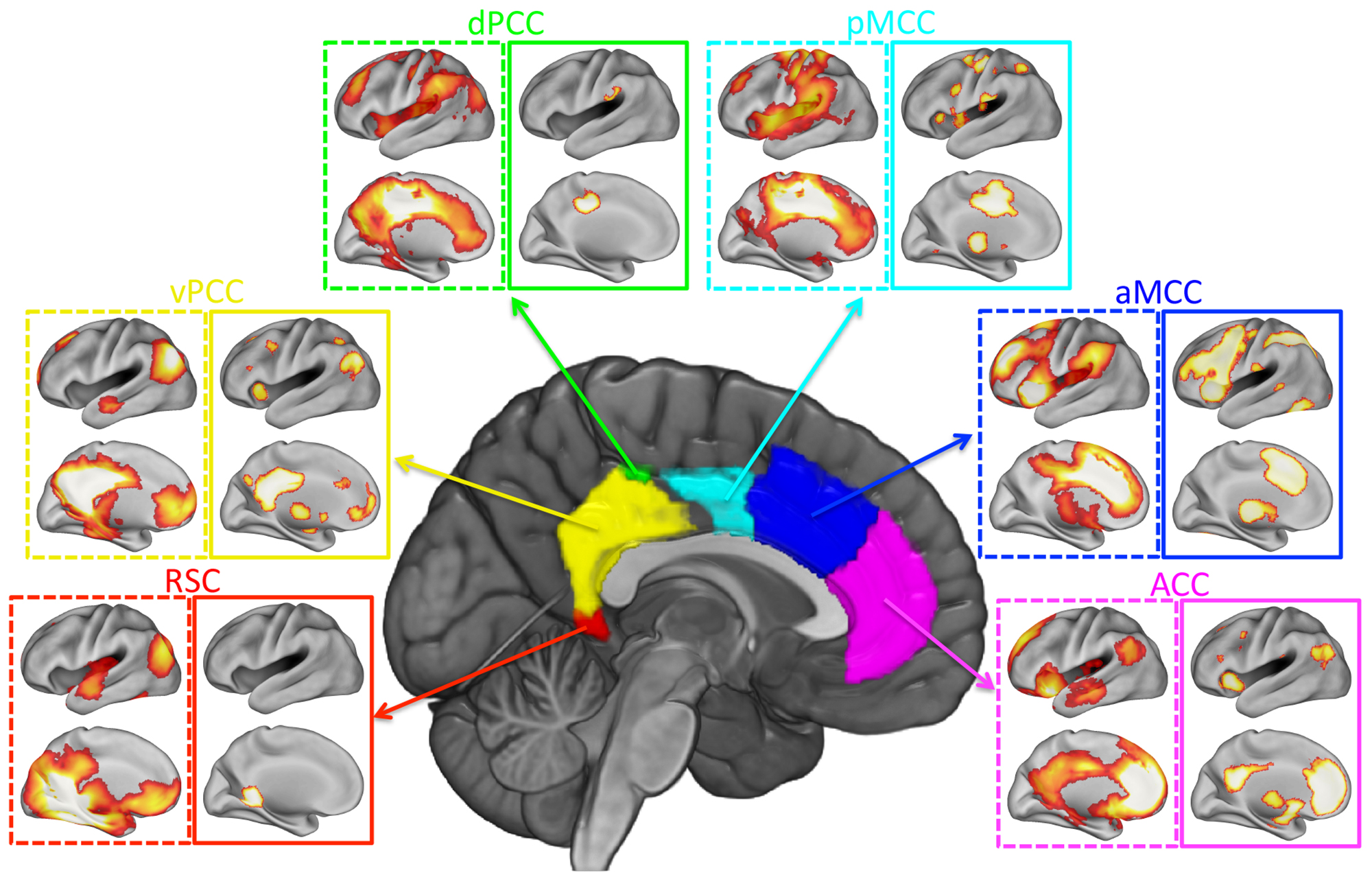 Brain connectivity in Autistic individuals – RHAR – Royal Holloway ...
